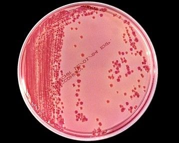 Airborne Klebsiella Pneumonia and Infections